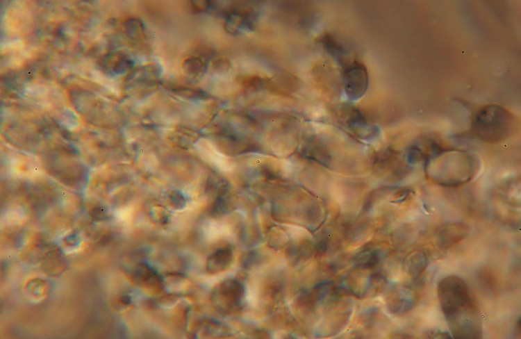 Labile crosticina bianca - foto 3259 (Trechispora farinacea)
